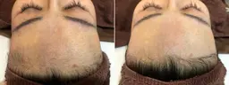 顔脱毛！　メイクのりアップ　洗顔付き～ローション塗布　　女性のみ