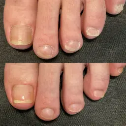 フットネイルケア