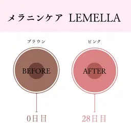 📍バストトップ  🌟1番人気！トーンアップで自信を持てるバストへ🌟ルメラ/メラニンケア