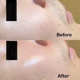 【メンズ】【現金支払いのみ】【小顔フェイシャル】クレンジング付きでぷるぷる肌に♪