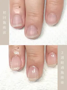 自爪育成モニター（original oil付）自爪風 ツヤ or マット仕上げ