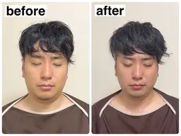 【新人スタッフモデル】【たるみ改善×リフトアップ】小顔矯正コース¥12,000→¥1,000