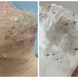 当日限定ゲリラクーポン【男性】脱毛期間もツルツルが続く˗ˋˏ  ヒゲ脱毛 ˎˊ˗通常¥5,500→¥1,000