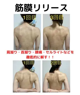 【凝り・疲れ改善】肩凝り・首凝り・腰痛などに痛気持ちいが癖になる💕筋膜リリースコース35分