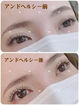下がりまつげにおすすめ、マツエク✖️マツパ、＆Healthy(アンドヘルシー) フラットラァシュ100本8000円