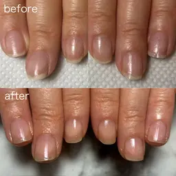 自爪育成、深爪矯正　ネイルケア、ジェル