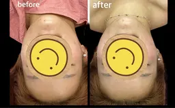 アジア大会ファイナリストが施術する【小顔美顔矯正】