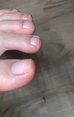 12月10日~14日限定 フットケア+足裏お手入れ(オフ込)