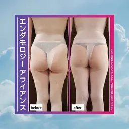 【ボディアライアンス】ボディラインを整え浮腫やセルライトやダイエットに効果あり！！✨お一人様１回限りです。