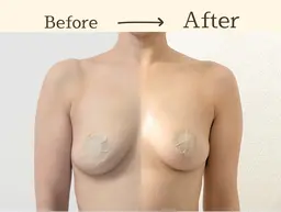 【下垂/左右差/流れ】が気になる方向けオーダーメイド施術　90分