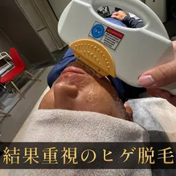 【プロ施術】清潔感を整えるメンズヒゲ脱毛 《脱毛範囲》口周り/頬/アゴ裏/