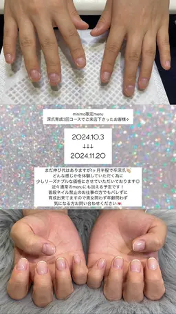 深爪育成💡ジェルワンカラー付き【3回分】🤝🏼✨深爪でお悩みの方是非✨