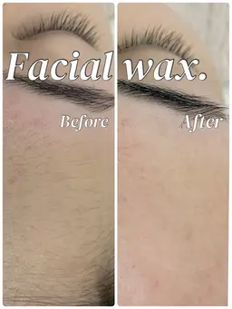 💕大好評つるつるお肌💕🫧フェイシャルwaxフル5️⃣パーツ🫧 女性限定🚺