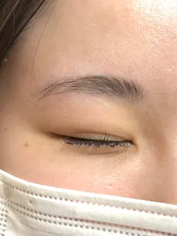 眉毛毛流れ矯正