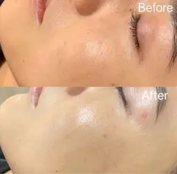 【艶肌＋美眉 特別セット】フェイシャルワックス脱毛＋美眉スタイリング