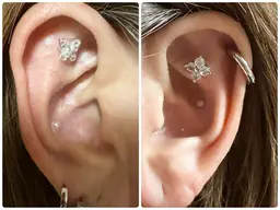 耳ツボジュエリー💎