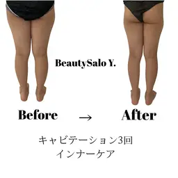 【ダイエットサロン気になるけど…まずはお試し】脂肪を落とすキャビテーション&ダイエットリンパマッサージ30分