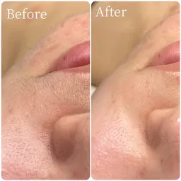 【🪞全顔フェイスワックス➕モデリングパック付き🪞】肌鎮静🌿産毛ゼロの艶肌✨💆🏼‍♀️