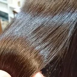 エックストリートメント（X treatment）