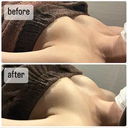 【二の腕脇下のハミ肉すっきり！】お背中二の腕痩身＋バストアップマッサージ＋美容液導入