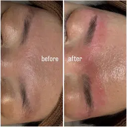 ハリウッドブロウリフトHBL