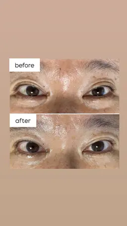 🌿【限定・練習モデル募集】ネトラバスティ👁️✨ 目元から癒しとデトックス