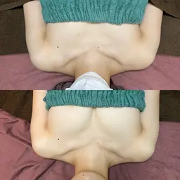 「おっぱいに触れない」バストトリートメント