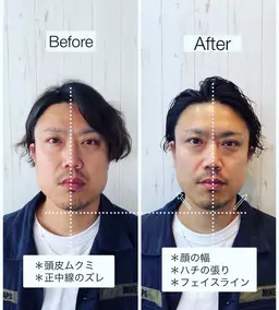 ✤モニター様限定✤ 骨格補正スパ+トリートメント