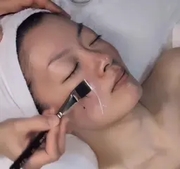 毛穴撲滅!ララピール+専用アンプル導入+LED