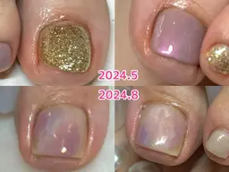 【巻き爪矯正つき】シンプルデザイン