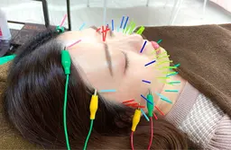 🌸【モデル募集】上級美容鍼体験コース🌸