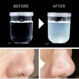 【モニター募集】全顔◎黒ずみ・毛穴の開き・一度で効果実感‼️ハイドロ毛穴洗浄ピーリング