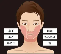 【口コミ割/男性専門】1回 ヒゲ脱毛💆※パック・ヘッドスパ付き