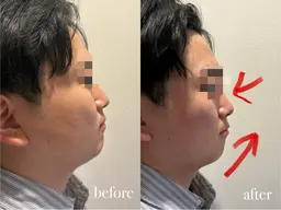 【本日限定価格‼️】小顔整体45分3300円✅💯