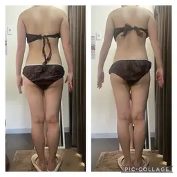 モデル様募集🌿ハイパーナイフ✖️美背中&二の腕集中痩せ🔥