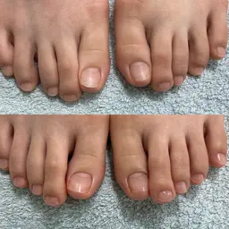 フットケア