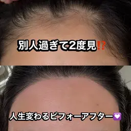 【眉×おでこ】１番人気❤️‍🔥ハリウッドブロウリフト×おでこワックス❤️‍🔥眉毛も！おでこも！