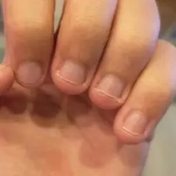 深爪育成