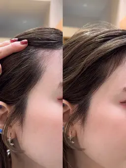 骨格補正うぶ毛カット🎀お禿げを解消します🫶🏻🫧シャンプーブローなし💫