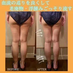 【インディバ超えラジオ波で下半身ケア🧸】ムチっとガチっと脚をほぐし美脚ケア🩰💗浮腫み・セルライト・冷え解決🎀