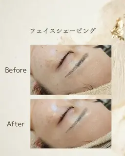 【顔】フェイスシェービング&アクティベーター