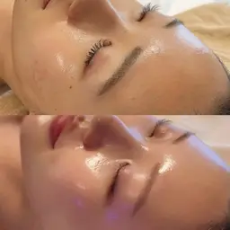 【ツヤ肌になりたい人必見👀✨】日本で韓国美肌が手に入る🕊ツヤ輝くGloss肌ピーリング70分🪞