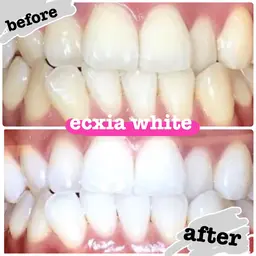 【口コミ投稿必須】平日10時〜16時迄!ホワイトニング★¥8,800→¥500★