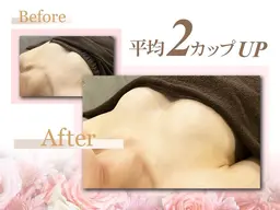 【お時間限定】プレミアム育乳コース★本気でボリュームアップしたい方★ハンドマッサージ✕生体電流✕光豊胸x美容液導入