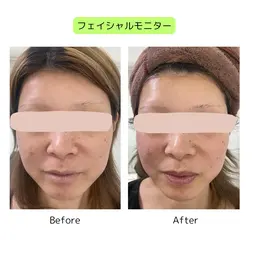 植物性ミネラルで整える小顔フェイシャル＋快楽ヘッドスパ