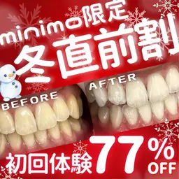 【11月限定⛄冬直前割⛄】8分照射×2回の定番メニュー💎お手軽セルフホワイトニングで理想の白い歯に☺️