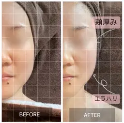 その他【フェイスUPx美白コース】(90min)【¥18,700→¥5,500】