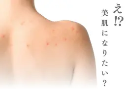 背中ニキビ・シミに◎背中美白トリートメント