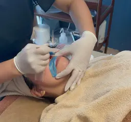💆‍♀️産毛もつるん♪お顔のWax脱毛