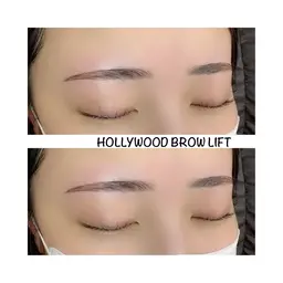 HBL(ハリウッドブロウリフト)